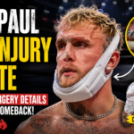 Jake Paul Jaw